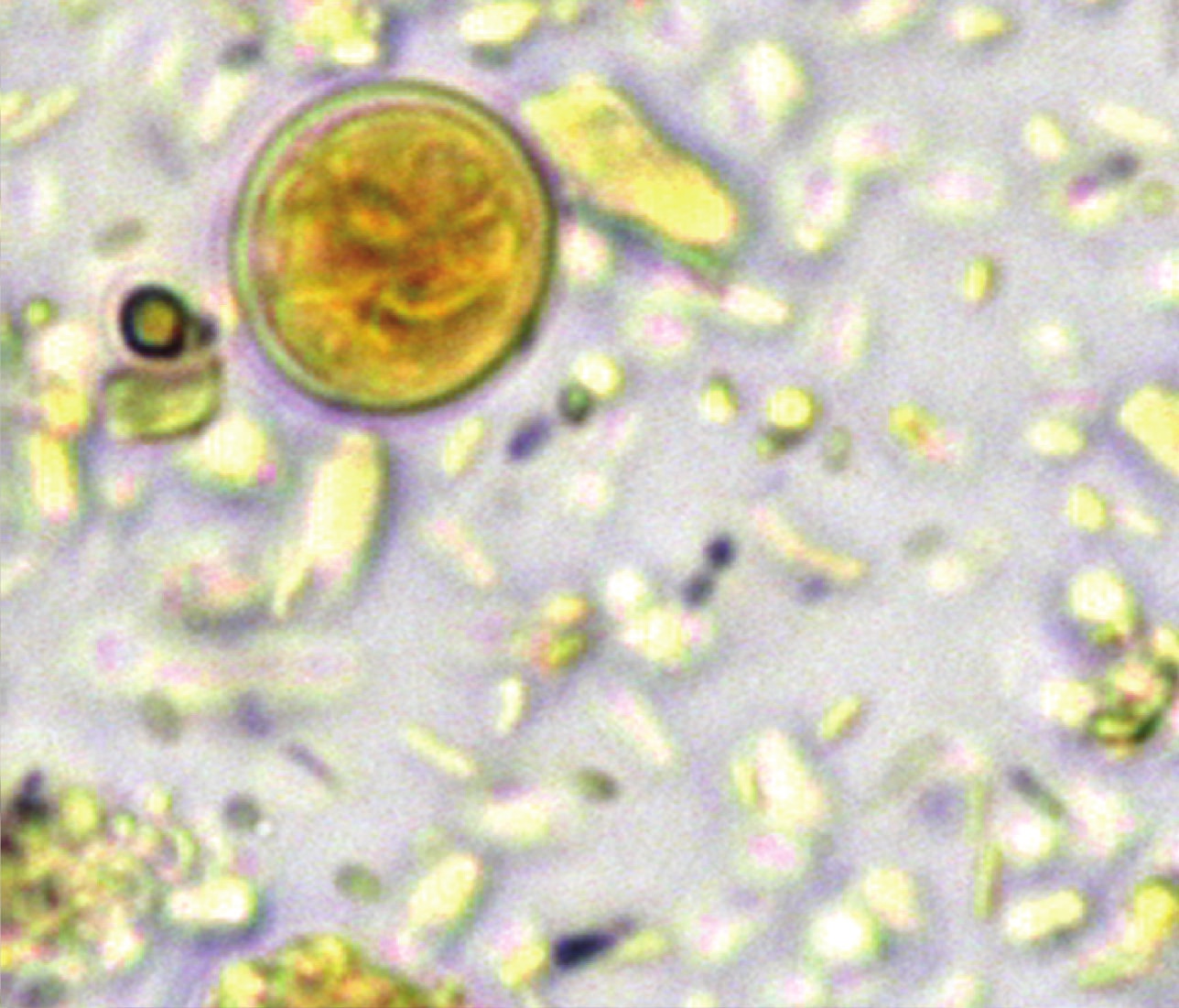 Vue au microscope d'un kyste de Giardia, rond, à paroi nette, teinté brun-orangé par le Lugol, avec des structures internes visibles.