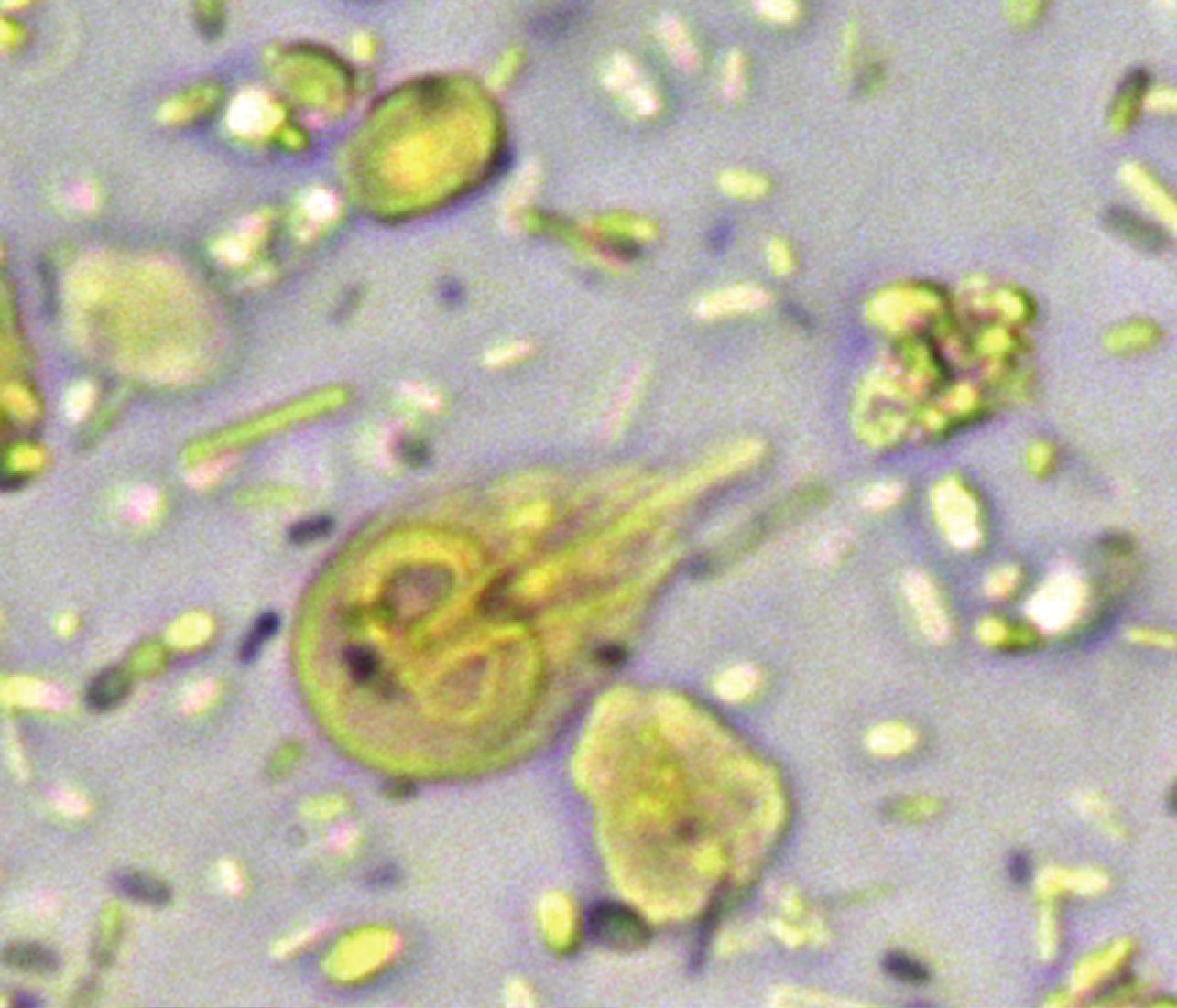 Vue au microscope d'un trophozoïte de Giardia, en forme de poire avec ses flagelles, teinté jaune-vert par le Lugol, au milieu de débris de selles.